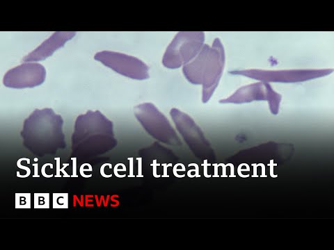 UK approves gene therapy to cure two blood disorders - BBC News