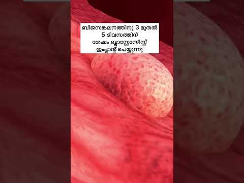 അമ്മയുടെ ഉള്ളിൽ ഒരു കുഞ്ഞുണ്ടാവുന്നത് ഇങ്ങനെയാണ്😍🤰👶🏻Week by Week Baby Growth #shorts #viral