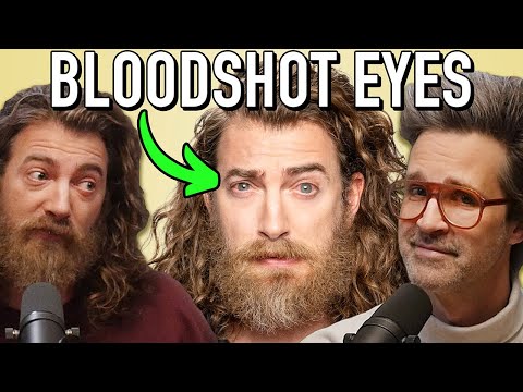 Why Rhett's Eyes Are Always So Red