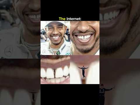 The Lewis Hamilton one is crazy 💀…