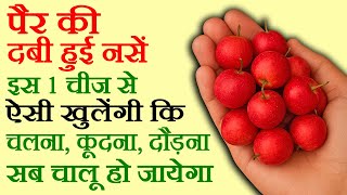 वेरीकोस वेंस का इलाज, नसों में दर्द का इलाज - Varicose Veins Ka ilaj - How To Cure Varicose Veins
