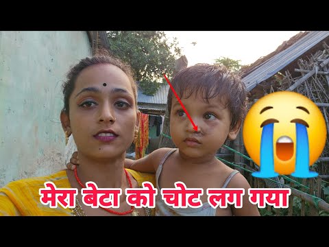मेरा बेटा को चोट लग गया 😭 #ruptaravlogs