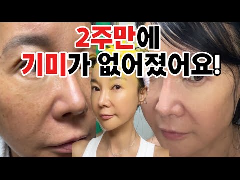 딱2주,기미가 지워진다구요👀 이건 진짜 역대급 입니다.