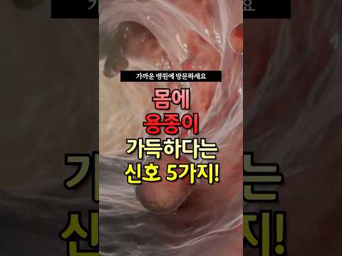 몸에 용종이 가득하다는 신호 5가지 #건강
