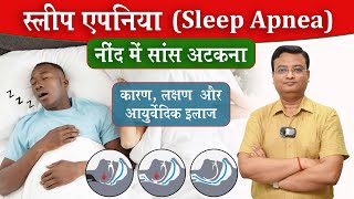 स्लीप एपनिया: खर्राटा या जानलेवा बीमारी | Sleep Apnea Ayurveda Treatment | Vd. Prateek Agrawal (939)