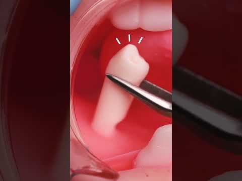 【超難易度SSレベル🔥】あくびしたら即負け！🦷歯科治療編ASMR