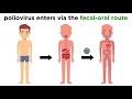 Understanding Poliovirus and Poliomyelitis