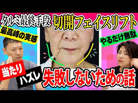 【切開リフト徹底解説2024 前編】粗悪なリフトアップ整形にNO！本当に意味がある値段に見合ったフェイスリフトとは【糸リフトの限界を超えるリガメント処理】美容外科歴20年ベテラン名医の本音