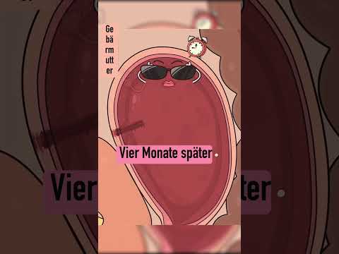 Warum hört die Periode nach dem Kaiserschnitt nicht auf? 😱