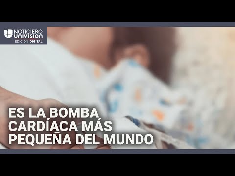 La FDA aprueba una bomba cardíaca para tratar a niños: el Dr. Juan explica qué es y cómo funciona