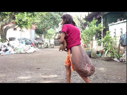 suegra corre de su casa a mujer de tumor gigante