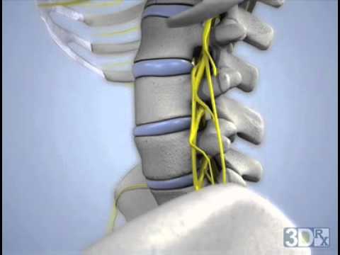 Subluxation - YouTube