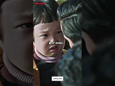 Öldün mü sen 🥺