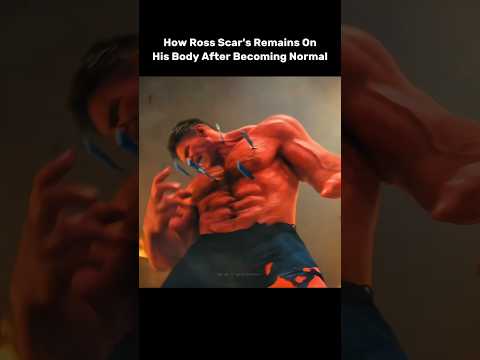 How Ross Scar's Remains On His Body After Becoming Normal 🤯