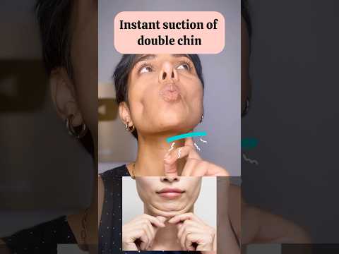 1 face exercise 2 anti age effects: Double chin and nasolabial fold
