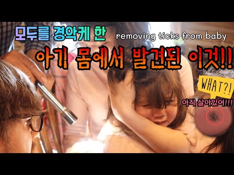 [미국일상] 경악주의!! 세린이 몸 속에 박혀있던 이것은 무엇?? | 진드기, 국제가족, 미네소타