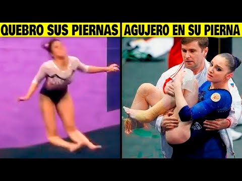 15 Peores Lesiones Mas Dolorosas En los Deportes 😨