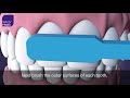 Dental Care Best Practices