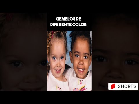 Gemelas con diferente color de piel #shorts #gemelos