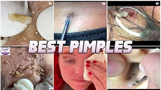 Looking for Great Pimple Popping and Great Sleep?