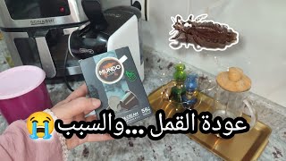 اكتشفنا سر القمل و السبب محير؟! 👹،روتينات ايامي بالعطلة كلها .....