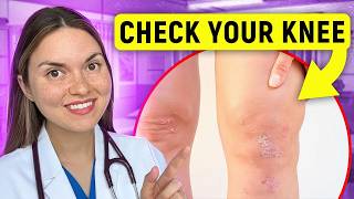 What Your KNEE Says About Your HEALTH: Arthritis Doctor Explains
