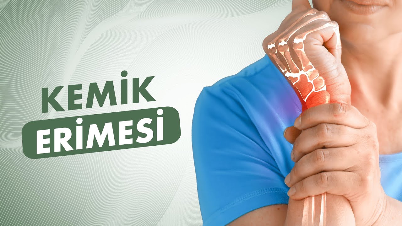 Kemik Erimesi (Osteoporoz) Nedir? Belirtileri, Risk Faktörleri ve Tedavisi