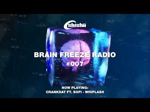 Brain Freeze Radio #007