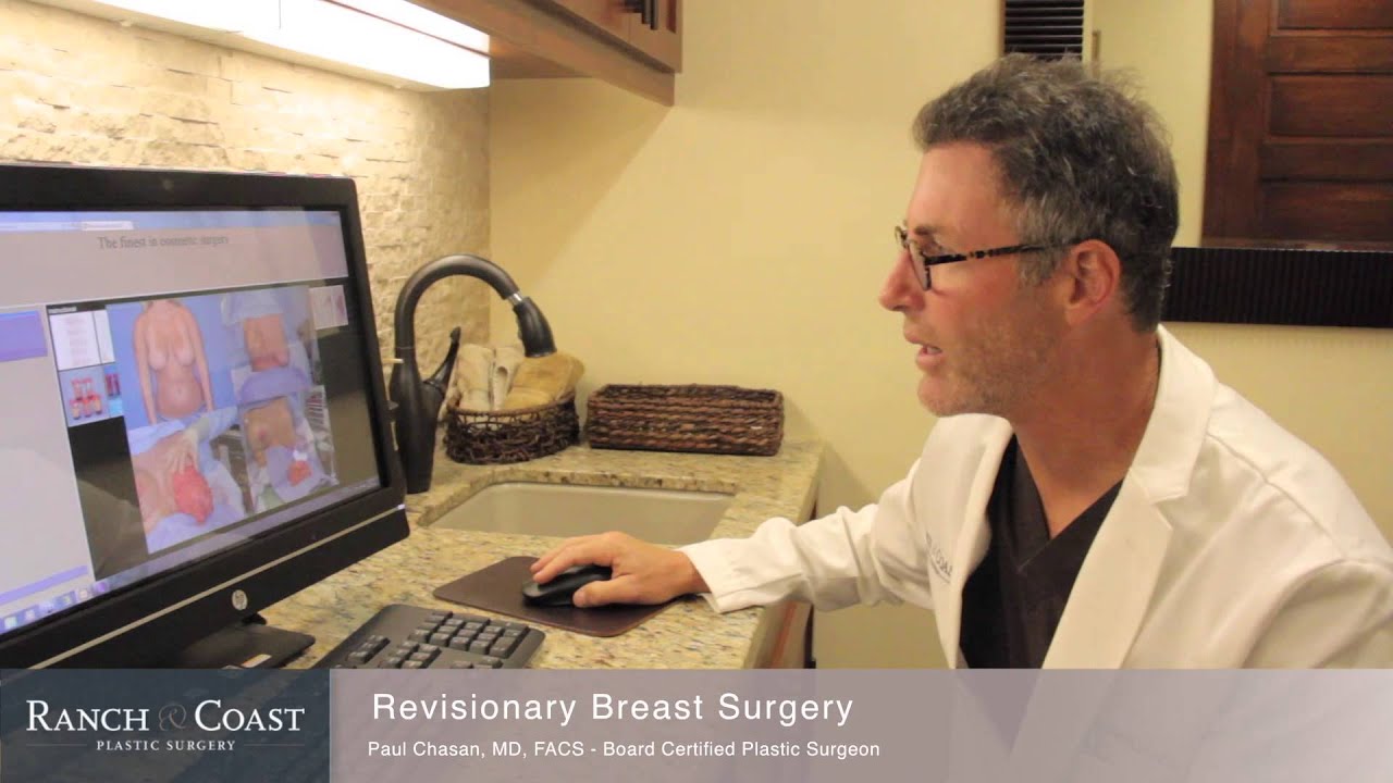 Revisionary Breast Surgery Patient Testimonial #1