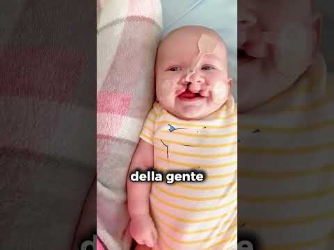 Ha subito 12 operazioni ma ora sorride