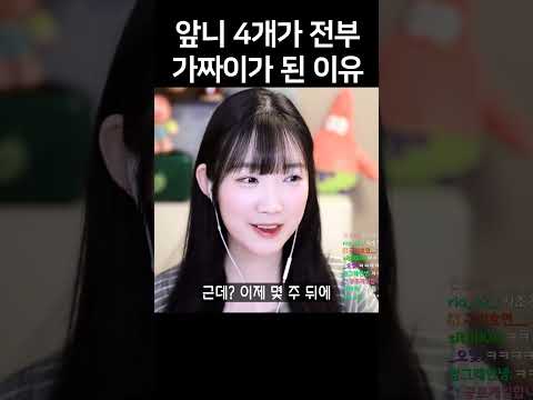 내 앞니 4개가 전부 다 가짜이가 된 이유