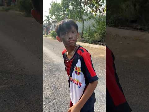 Đẹp Trai Đi Mua Chân Gà Ai Cũng Khen Gái Mà Gặp Thì Chạy Mất Luôn Đôi Dép #shorts