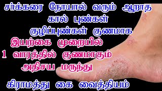 சர்க்கரை நோயால் வரும் கால் புண் குணமாக/Sugar Punnu Marunthu In Tamil/How To Cure Diabetic Foot Wound