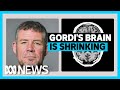 Understanding CTE and Its Implications
