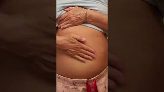 CASTOR OIL FOR LIVER CARE. LIKE AND SUBSCRIBE ♥️ #castoroil