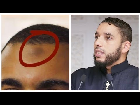 MARQUE SUR LE FRONT, SIGNE D'EXTRÉMISME ?