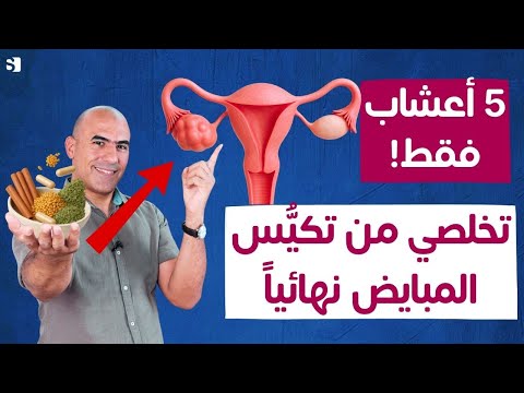 5 أعشاب فعالة لعلاج تكيس المبايض وتنظيم الهرمونات طبيعيًا