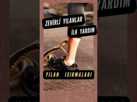 Yılan ısırırsa ne yapacağız? Yılan sokmalarında ilk yardım nasıl olur Türkiyede yılanlar zehirli mi?
