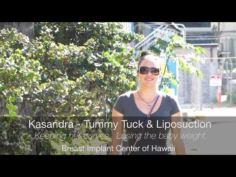 Tummy Tuck and Liposuction Video Review 2 - Mommy Makeover Hawaii