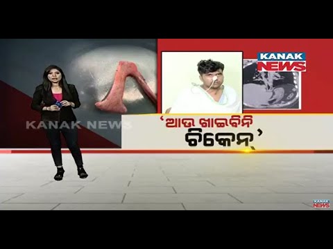 Damdar Khabar: Chicken Bone Stucks In Youths Throat For 8 Days, Gets Out After Surgery, Bhubaneswar