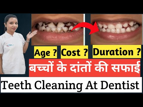 बच्चों के दांतों की सफाई |Teeth Cleaning At Dentist |Kids Teeth Cleaning At Dentist |Teeth Whitening