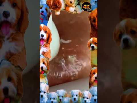 Big Cystic Acne Blackheads Extraction Blackheads & Milia, Whiteheads Removal Pimple Popping