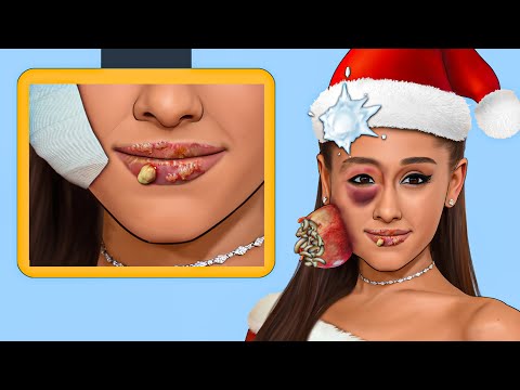 ASMR Remove Big Acne Infected Face Ariana - Deep Cleaning Animation