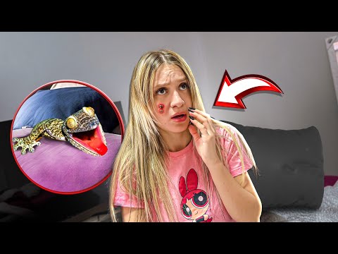 UM BICHO ESTRANHO MORDEU O ROSTO DA PRODUÇÃO ENQUANTO ELA DORMIA!!
