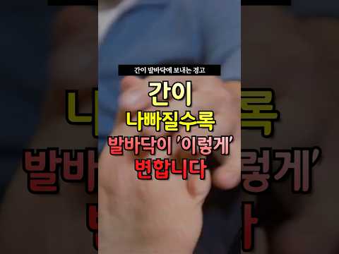 간이 나빠질수록 발바닥이 ‘이렇게’ 변합니다 #건강