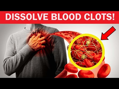 12 Foods That Dissolve Blood Clots Naturally !