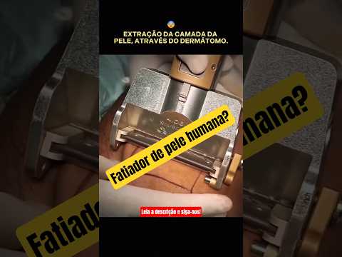Dermatomo: O Aparelho Essencial para Enxertos de Pele em Cirurgias Reconstrutivas #shorts