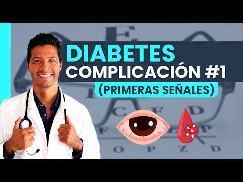 PÉRDIDA DE VISTA POR DIABETES ¡SEÑALES DE ALERTA! | RETINOPATÍA DIABÉTICA