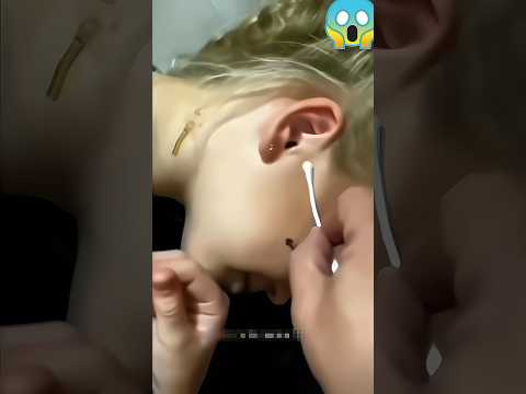 Amazing_Ear_👂🤔_Magic_Trick_😱💯___Reverse_◀️_video___#ytshorts #shorts #viral