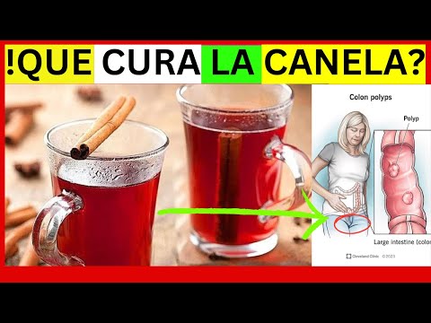 Aprovechando el poder de la CANELA: ¡Revelados sus Sorprendentes Usos!